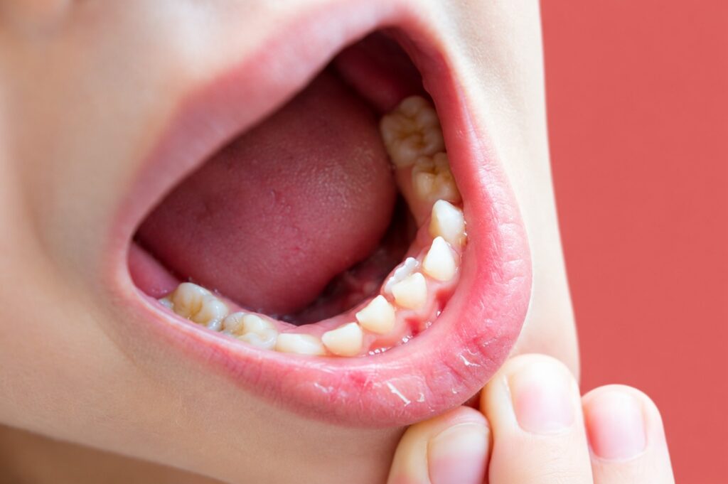 Bolton dentist
